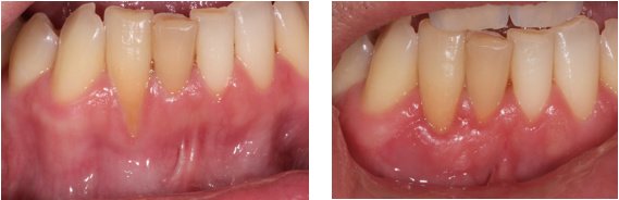 Michael Wasemiller, DDS - Michael Wasemiller, DDS