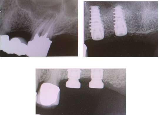 Michael Wasemiller, DDS - Michael Wasemiller, DDS