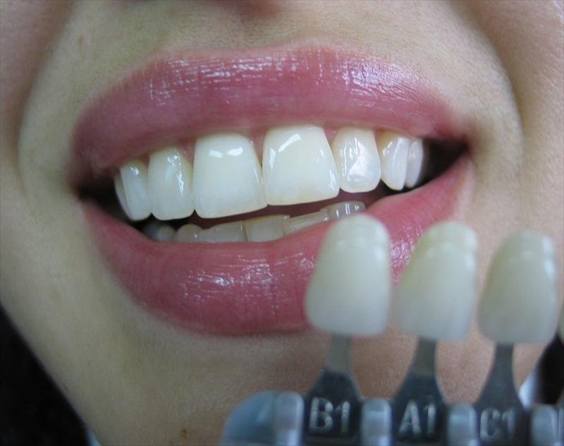 Michelangelo Dental Studio - Michelangelo Dental Studio