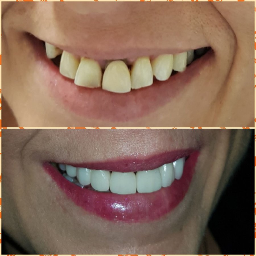 Mile End Dental Clinic - Mile End Dental Clinic