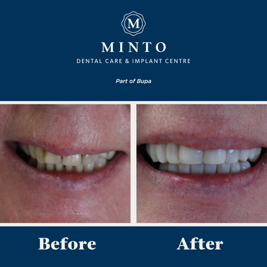 Minto Dental Practice & Implant Centre - Edinburgh - Minto Dental Practice & Implant Centre - Edinburgh