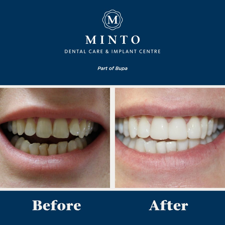 Minto Dental Practice & Implant Centre - Edinburgh - Minto Dental Practice & Implant Centre - Edinburgh