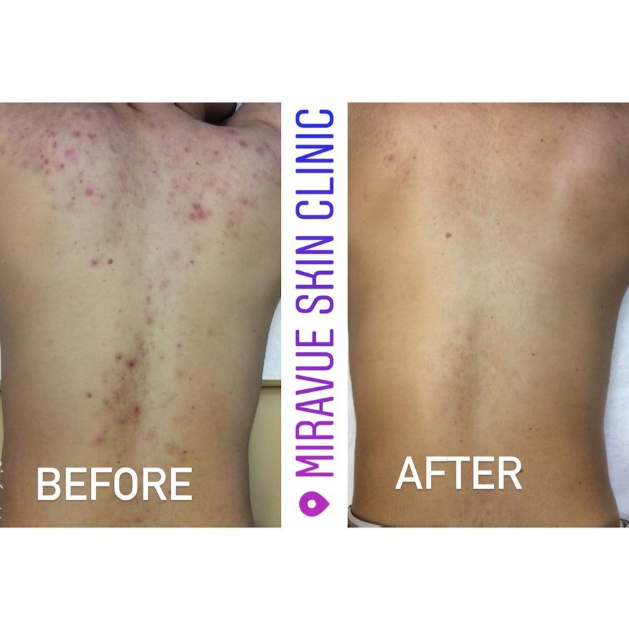 Miravue Skin Clinic - Ealing - Miravue Skin Clinic - Ealing