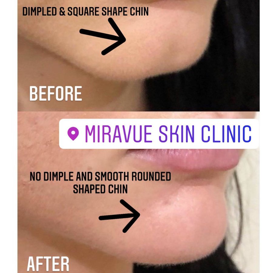 Miravue Skin Clinic - Southall - Miravue Skin Clinic - Southall