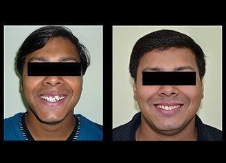 Mission Smile Dental Centre - Mission Smile Dental Centre