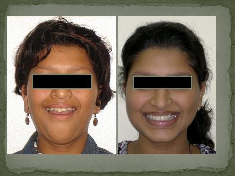 Mission Smile Dental Centre - Mission Smile Dental Centre