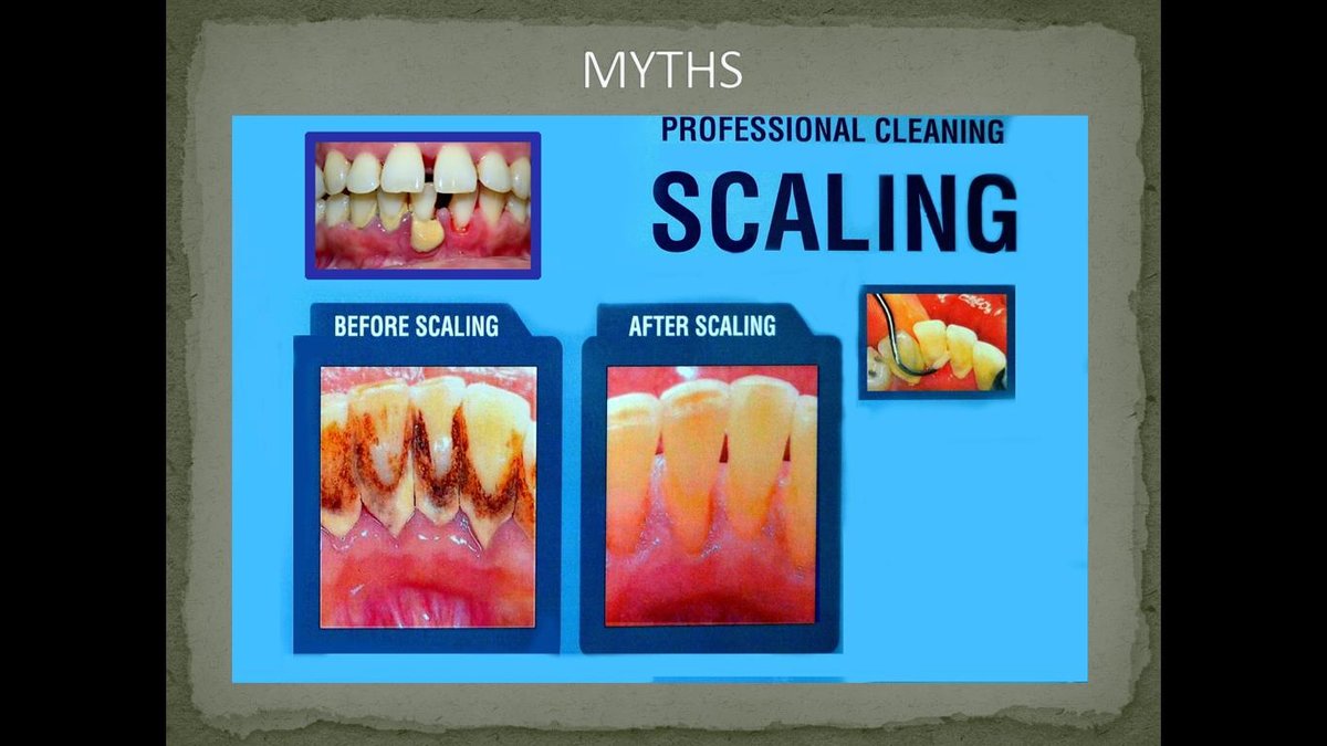 Mission Smile Dental Centre - Mission Smile Dental Centre