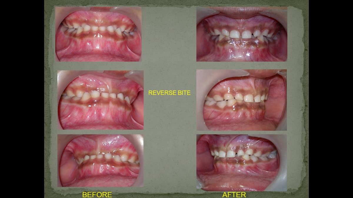 Mission Smile Dental Centre - Mission Smile Dental Centre