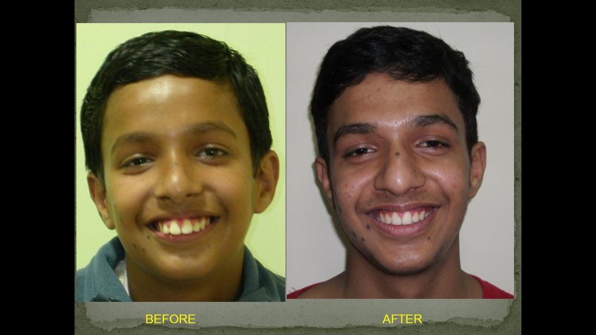 Mission Smile Dental Centre - Mission Smile Dental Centre