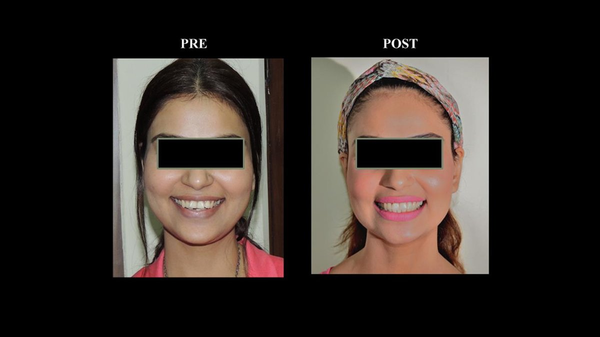 Mission Smile Dental Centre - Mission Smile Dental Centre