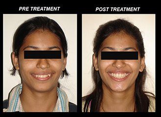 Mission Smile Dental Centre - Mission Smile Dental Centre