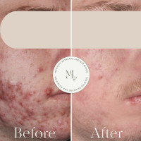 ML Aesthetic Medicine - ML Aesthetic Medicine