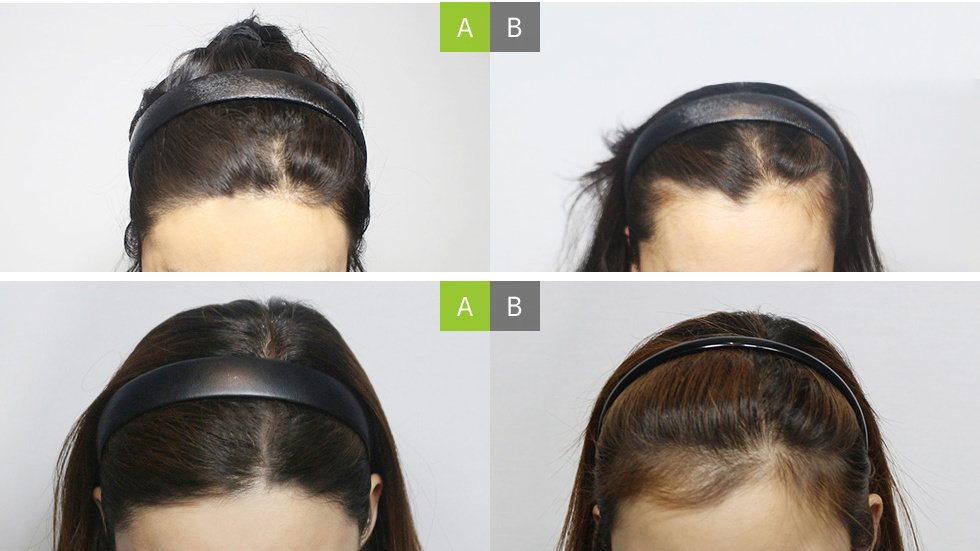 Moaman Hair Transplant Clinic - Moaman Hair Transplant Clinic