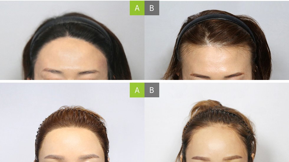 Moaman Hair Transplant Clinic - Moaman Hair Transplant Clinic