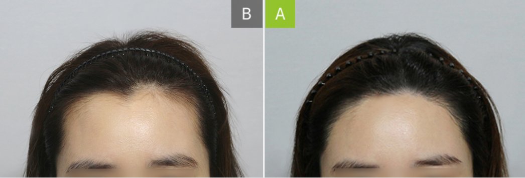 Moaman Hair Transplant Clinic - Moaman Hair Transplant Clinic