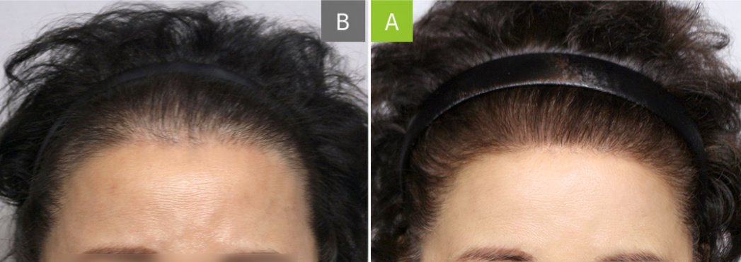 Moaman Hair Transplant Clinic - Moaman Hair Transplant Clinic