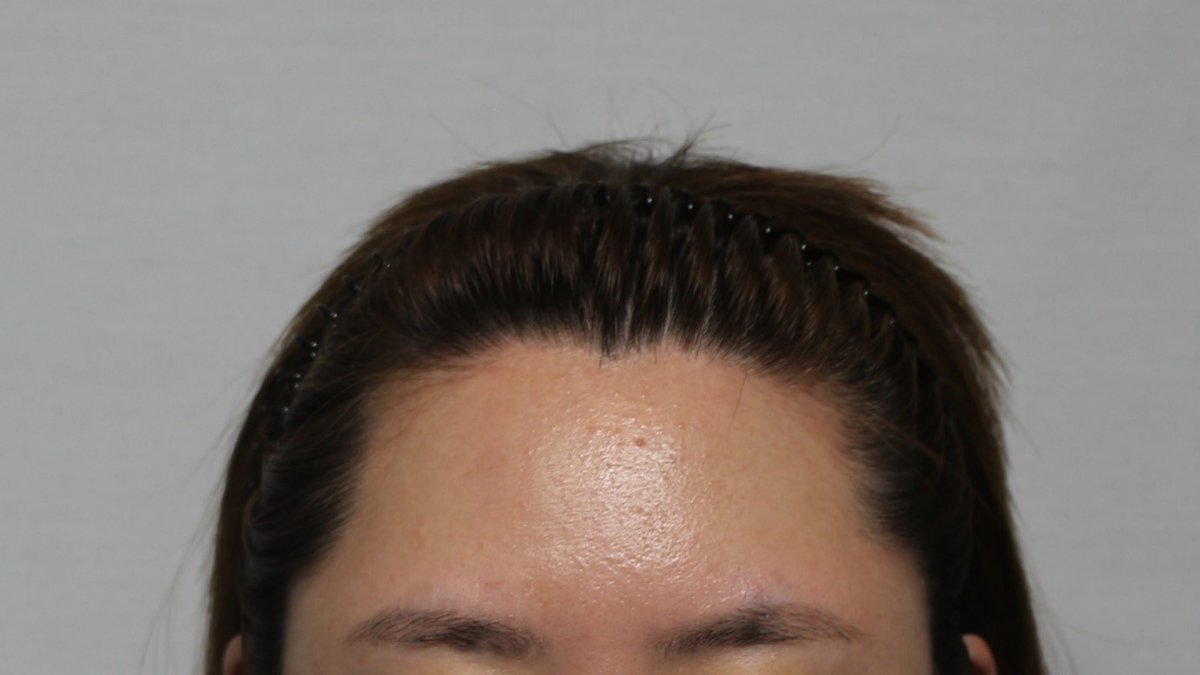 Moaman Hair Transplant Clinic - Moaman Hair Transplant Clinic