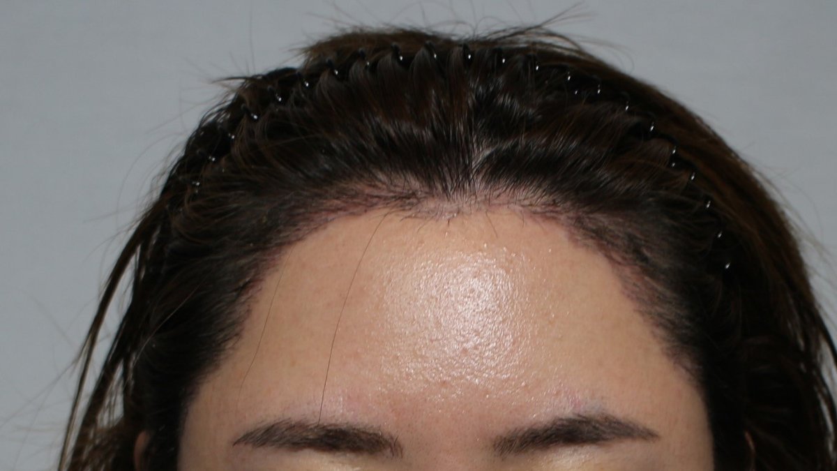 Moaman Hair Transplant Clinic - Moaman Hair Transplant Clinic