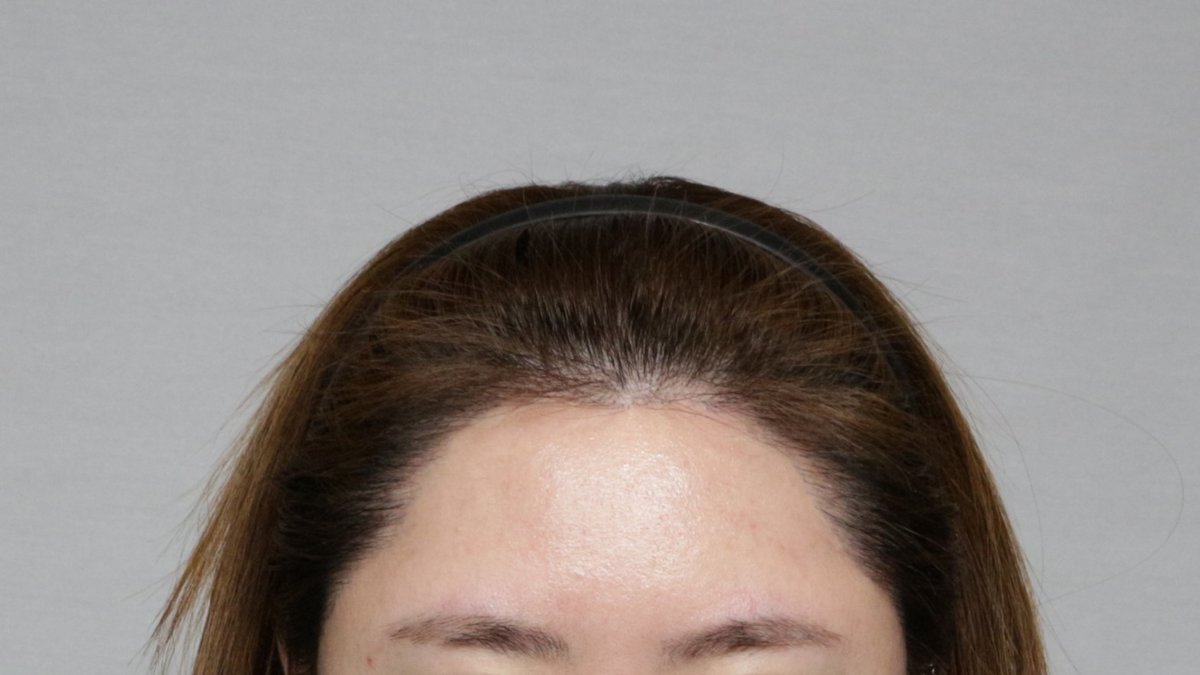 Moaman Hair Transplant Clinic - Moaman Hair Transplant Clinic