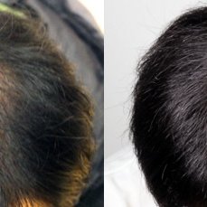 Moaman Hair Transplant Clinic - Moaman Hair Transplant Clinic