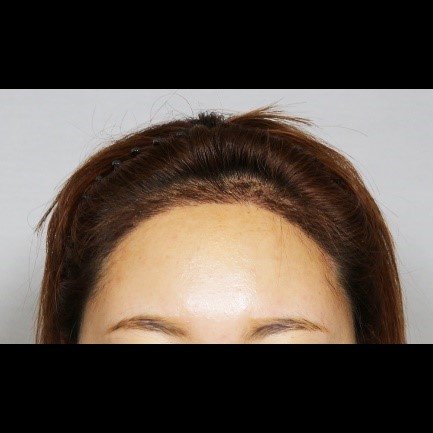 Moaman Hair Transplant Clinic - Moaman Hair Transplant Clinic