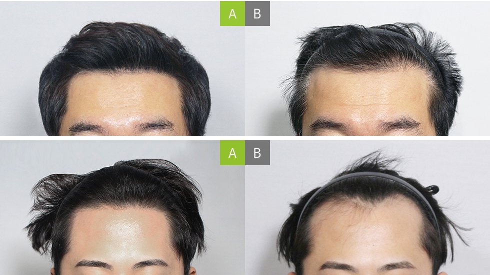 Moaman Hair Transplant Clinic - Moaman Hair Transplant Clinic