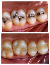Monarch Dentistry - Monarch Dentistry