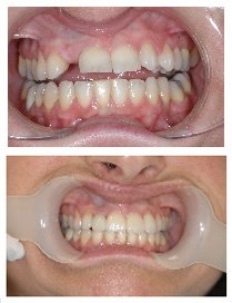 Monarch Dentistry - Monarch Dentistry