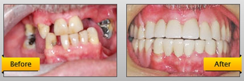 Monarch Dentistry - Monarch Dentistry