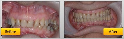 Monarch Dentistry - Monarch Dentistry