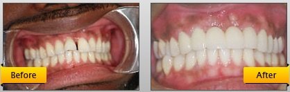 Monarch Dentistry - Monarch Dentistry