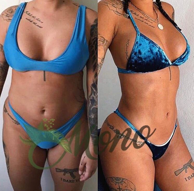 Mono Cosmetic Surgery Center - Kusadasi - Mono Cosmetic Surgery Center - Kusadasi