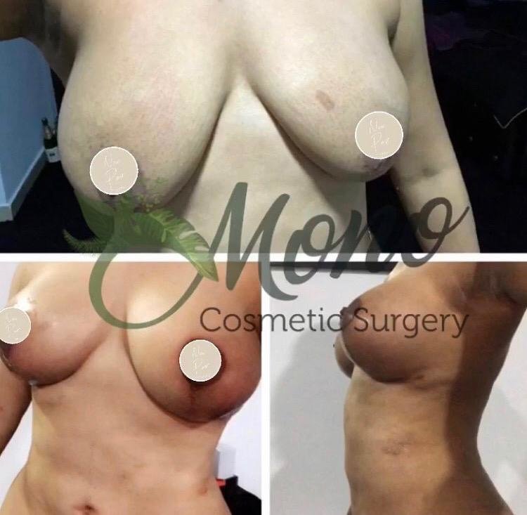 Mono Cosmetic Surgery Center - Kusadasi - Mono Cosmetic Surgery Center - Kusadasi