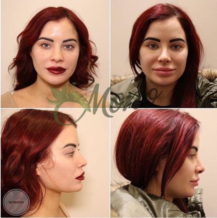 Mono Cosmetic Surgery Center - Kusadasi - Mono Cosmetic Surgery Center - Kusadasi