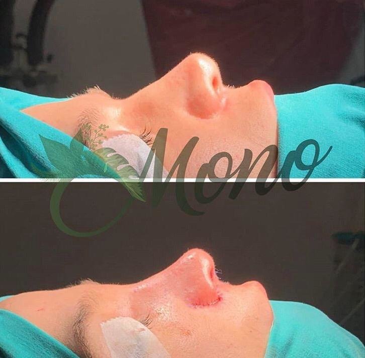 Mono Cosmetic Surgery Center - Kusadasi - Mono Cosmetic Surgery Center - Kusadasi