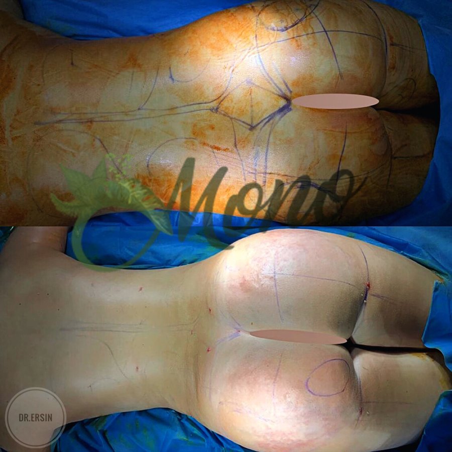 Mono Cosmetic Surgery Center - Mono Cosmetic Surgery Center
