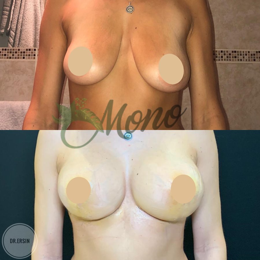 Mono Cosmetic Surgery Center - Mono Cosmetic Surgery Center