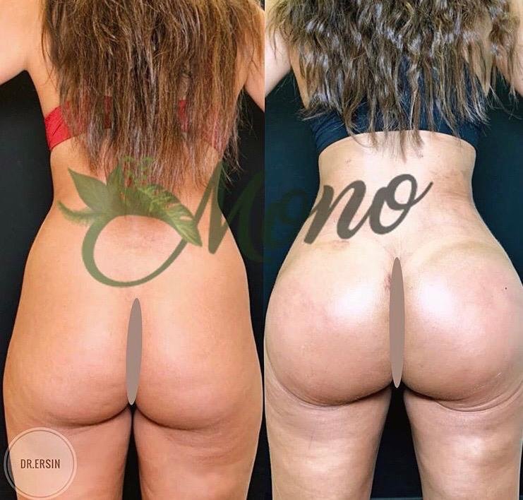 Mono Cosmetic Surgery Center - Mono Cosmetic Surgery Center