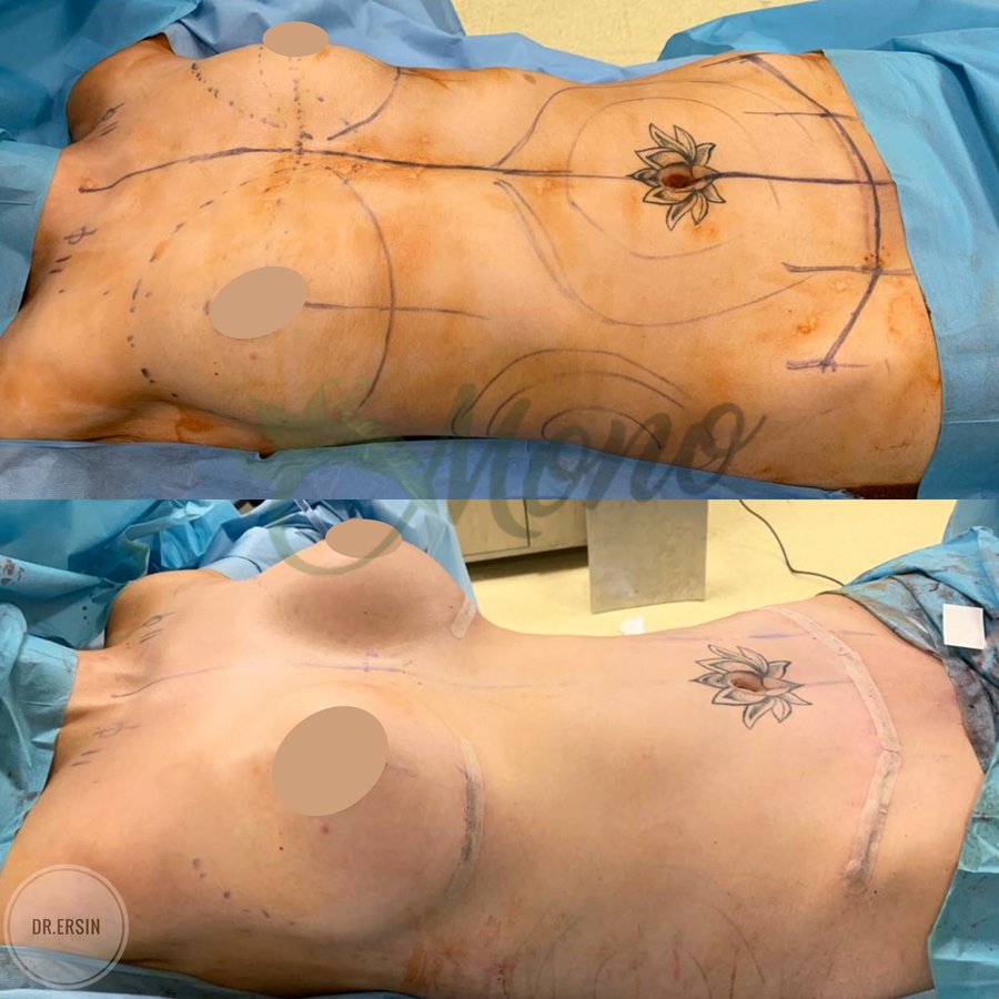 Mono Cosmetic Surgery Center - Mono Cosmetic Surgery Center