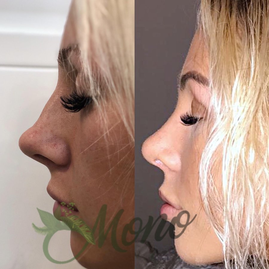 Mono Cosmetic Surgery Center - Mono Cosmetic Surgery Center