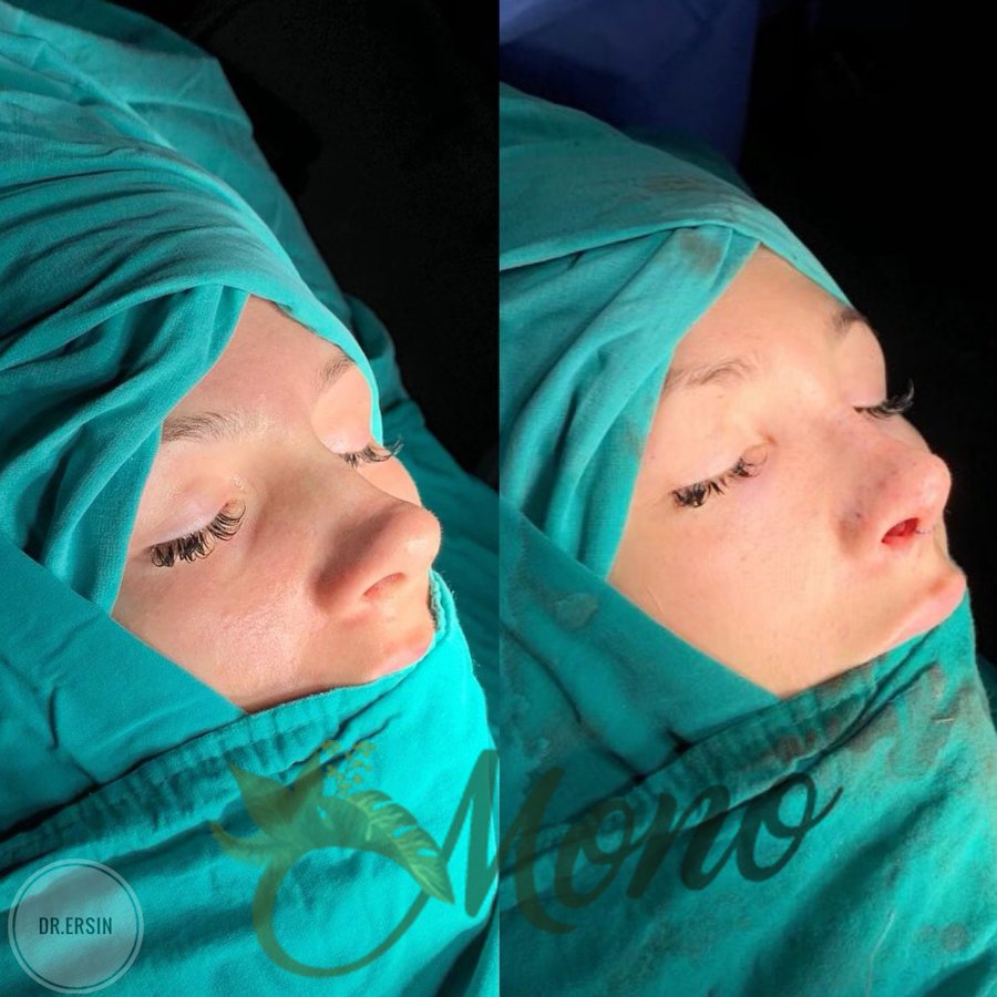 Mono Cosmetic Surgery Center - Mono Cosmetic Surgery Center