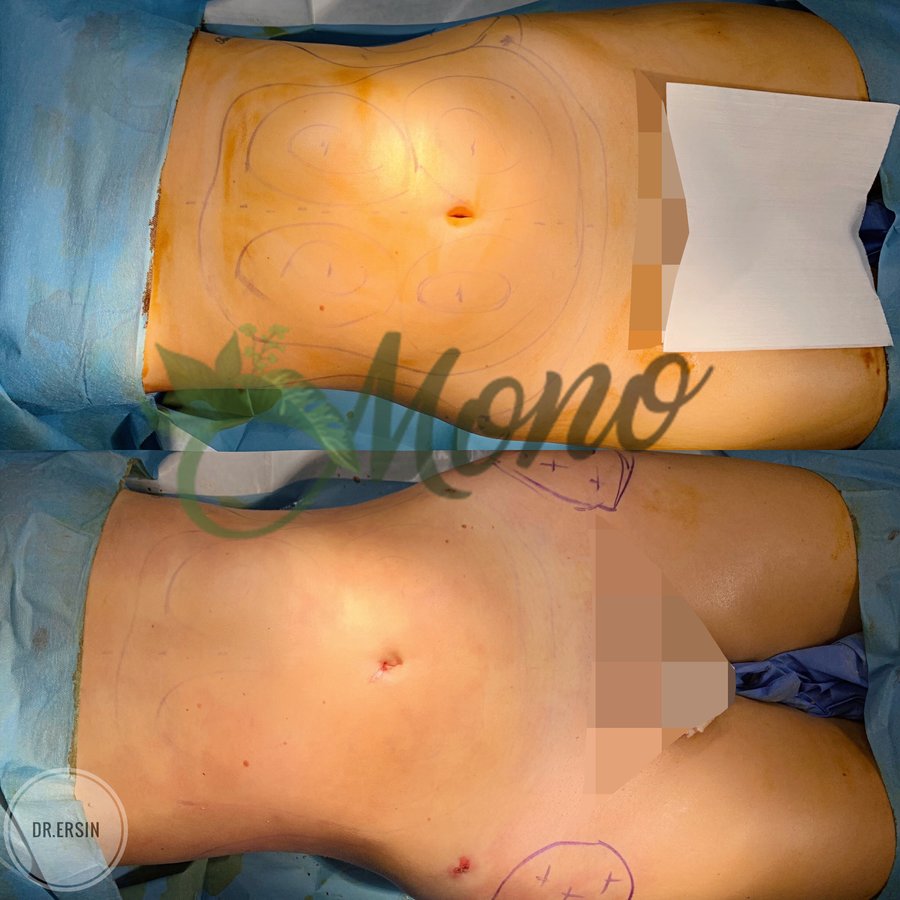 Mono Cosmetic Surgery Center - Mono Cosmetic Surgery Center