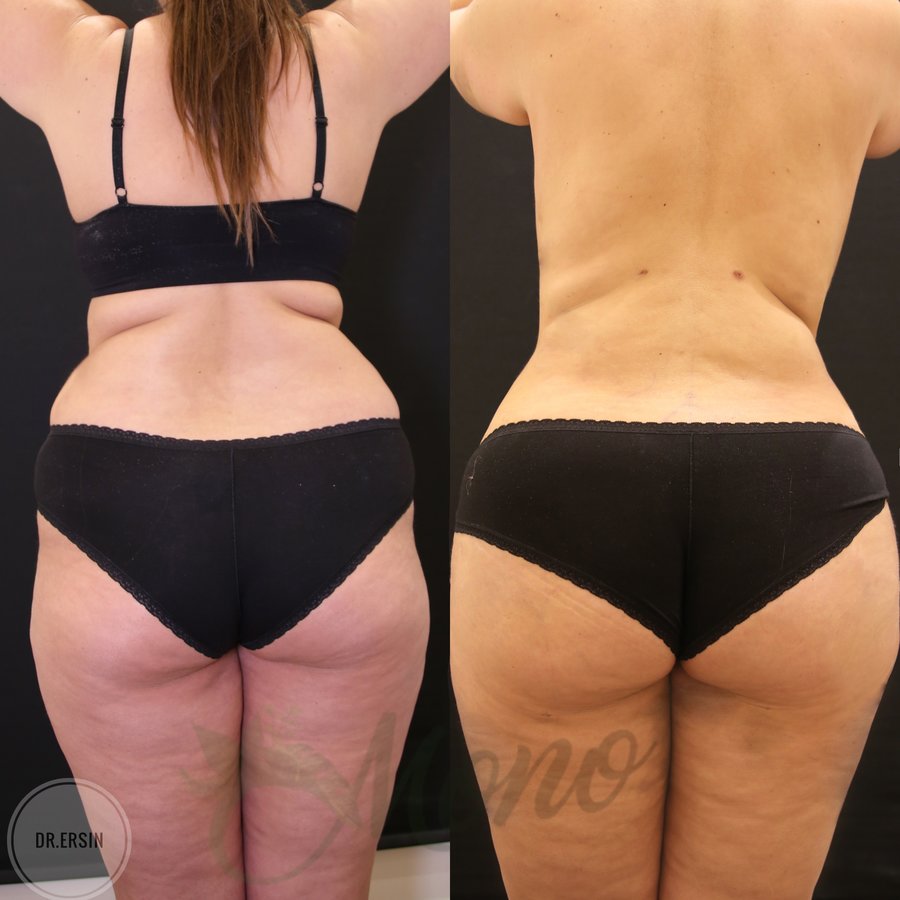 Mono Cosmetic Surgery Center - Mono Cosmetic Surgery Center