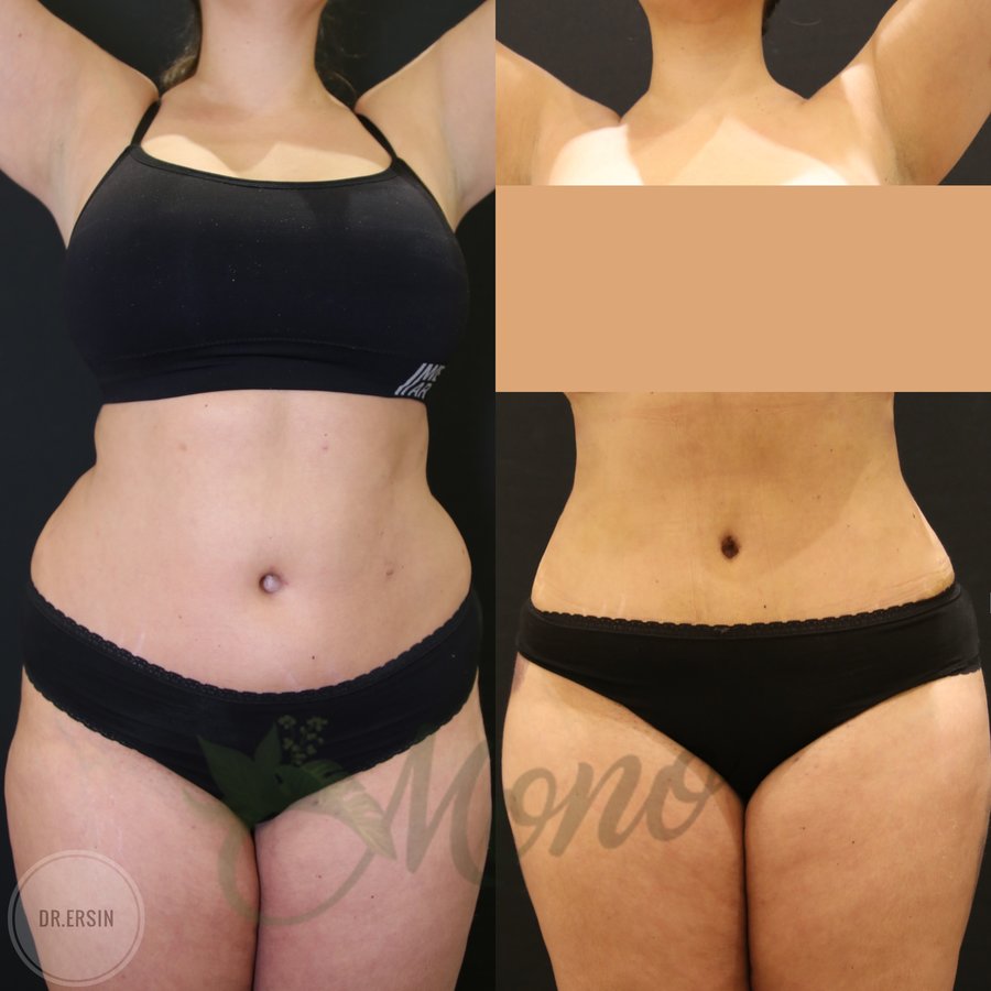 Mono Cosmetic Surgery Center - Mono Cosmetic Surgery Center