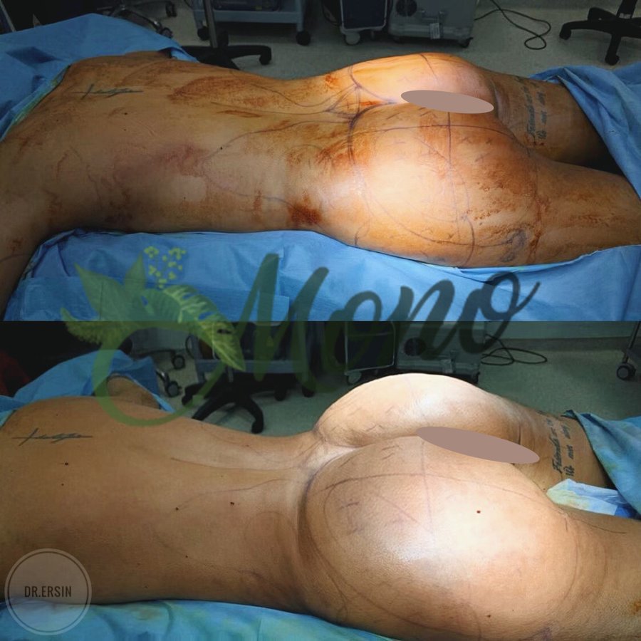 Mono Cosmetic Surgery Center - Mono Cosmetic Surgery Center