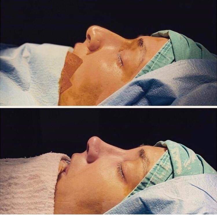 Mono Cosmetic Surgery Center - Mono Cosmetic Surgery Center