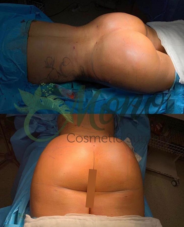 Mono Cosmetic Surgery Center - Mono Cosmetic Surgery Center