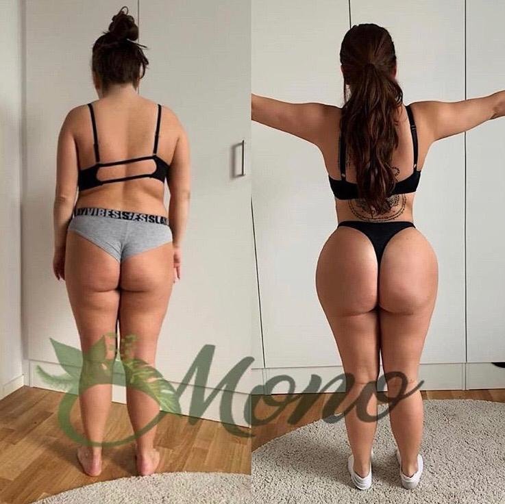 Mono Cosmetic Surgery Center - Mono Cosmetic Surgery Center