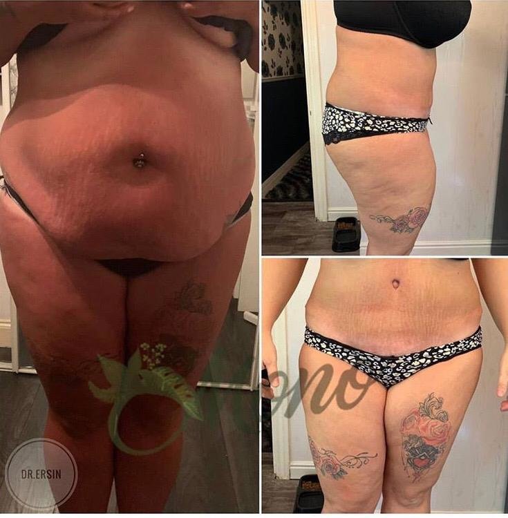 Mono Cosmetic Surgery Center - Mono Cosmetic Surgery Center