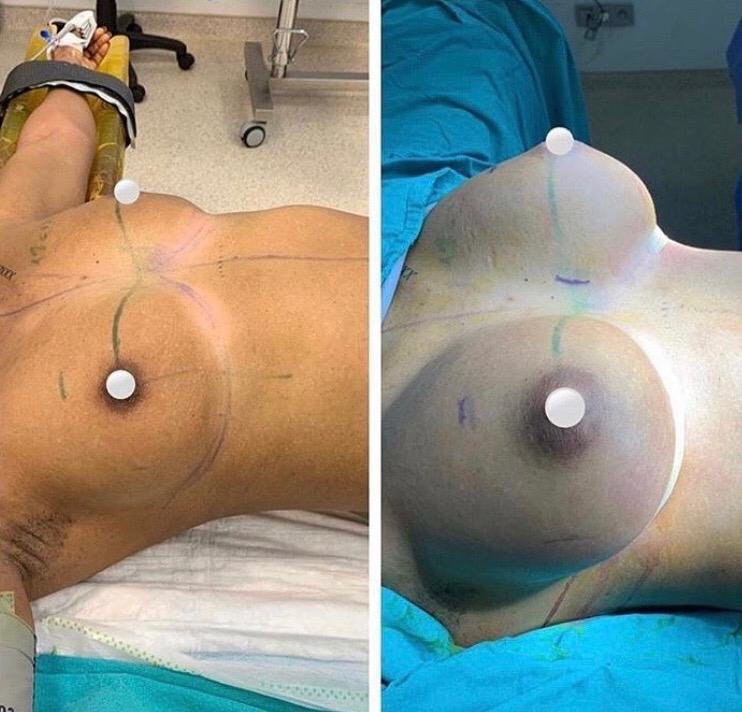 Mono Cosmetic Surgery Center - Mono Cosmetic Surgery Center